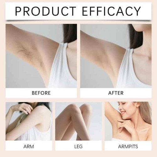 Hair Removal Cream, No Shave Hair Remover for Women, Fast and Gentle, Moisturizes and Nurtures Skin, Leaves Skin Smooth & Soft, 5.29 oz (1)