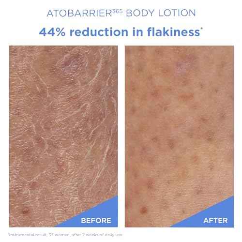 AESTURA ATOBARRIER365 Korean Body Lotion with Ceramides | Fast-Absorbing Moisturizer for Dry, Sensitive & Eczema-Prone Skin | Non-Comedogenic, Fragrance-Free, 400 mL / 13.5 fl oz
