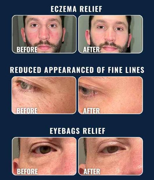 Prettyboy Face Revival Gel Moisturizer For Men - Hydrating Cream That Refreshes Dry Skin, Irritation, & Redness - Supports Anti Aging & Anti Wrinkle - Fragrance Free - 1 Count