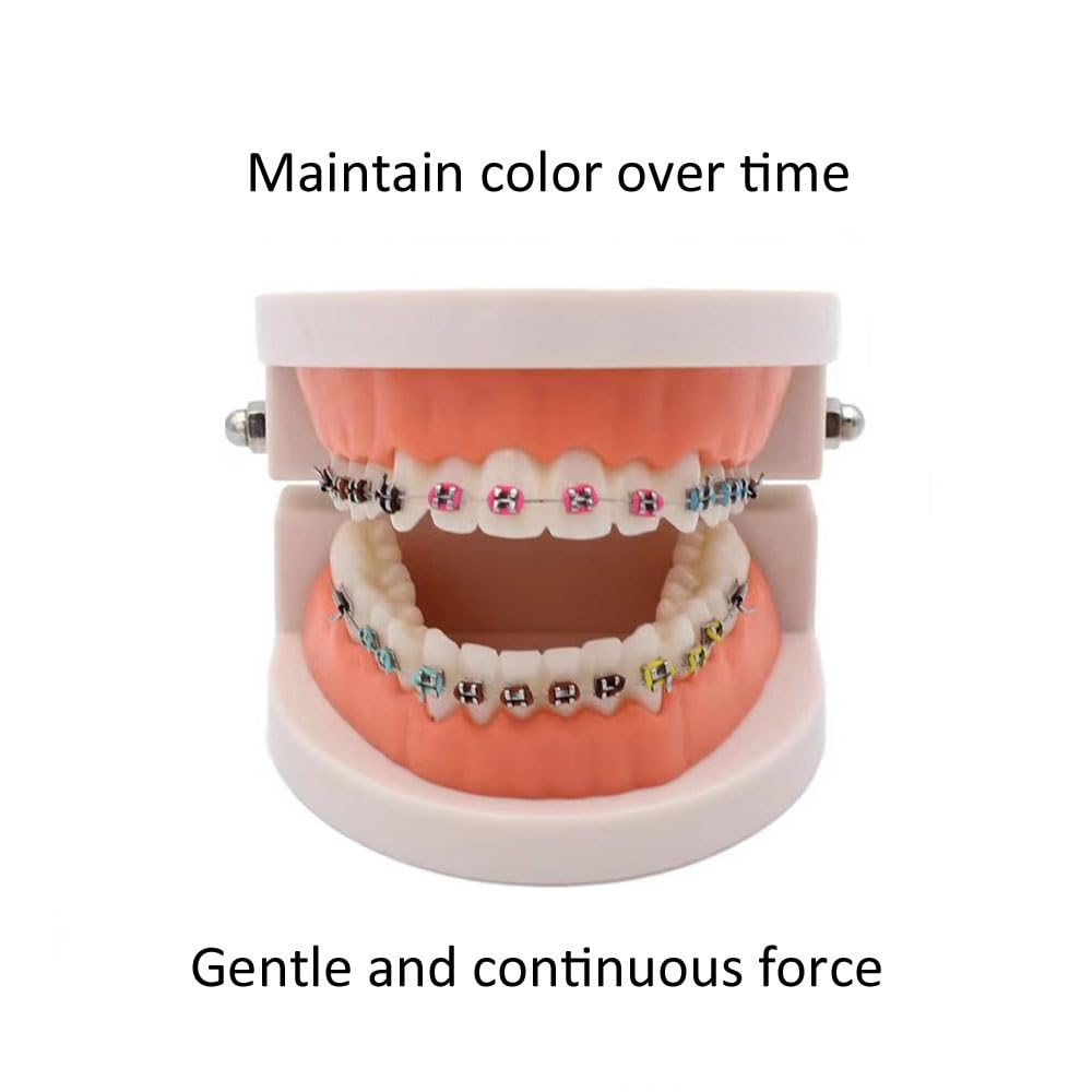 1040 O-Rings - Orthodontic Elastomeric Ligature Ties for Braces. Elastic O-Ring Rubber Bands for Orthodontic Brackets. (Lilac)