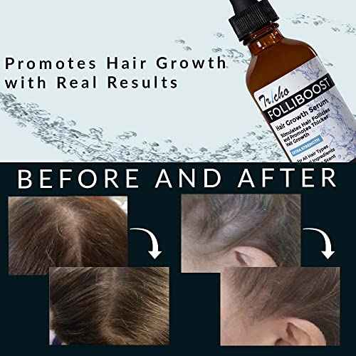 Tricho Labs Folliboost Hair Growth Serum - Natural-Based Formula w/Biotin & Peppermint Oil - Hair Care for Thicker & Fuller Hair - 2oz, 3-Pack