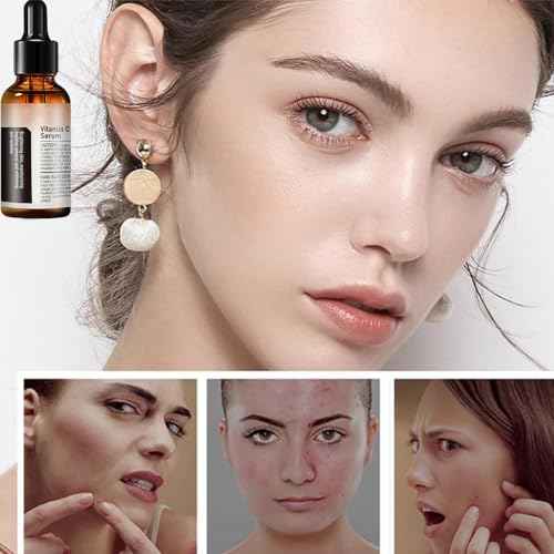 Vitamin C Serum For Face, Anti Aging Face Serum with Vitamin C, Hyaluronic Acid, Vitamin E ? Brightening Formula ? Improve Appearance of Dark Spots, Tone, Fine Lines & Wrinkles (2Pcs)