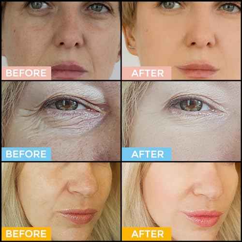 Facial Skin Care Set? Retinol Serum, Vitamin C & Hyaluronic Acid for Face ? Anti Aging Face Serum Set for Women ? Firm, Wrinkle Smoothing, Dark Spot Corrector, Brighten Dullness