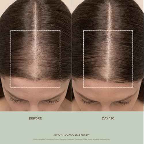 VEGAMOUR GRO+ Advanced Balancing Conditioner | Hydrates the Scalp, Nourishes and Softens Hair | For Severe Signs of Thinning | Color Safe, Vegan, Cruelty-Free, Formulated Without Silicones (8 Fl Oz)