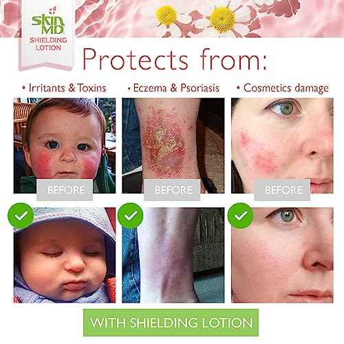 Skin MD Shielding Lotion 4oz - 3 Pack Hydrating Body Lotion for Sensitive Skin with Dispenser | Non-Greasy, Fast-Absorbing Moisturizer with Plant-Based Ingredients, Eczema & Psoriasis Relief