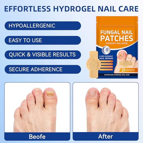 Nail Patches Toenail Treatment Extra Strength, 8-Hour Overnight Nail Fast Acting Repair Effortless Hydrogel Nail Care and Repair for Damaged Nails Overnight Renewal 21 Patches