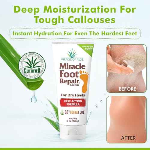 Miracle Foot Repair Cream (8 oz & 1 oz) Repairs Dry Cracked Heels and Feet, 60% Pure UltraAloe Moisturizes, Softens, and Repairs