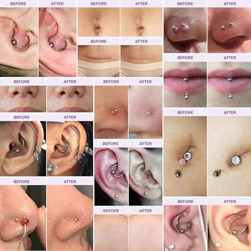 Keloid Bump Gel, Scar Prevention, Skin Renewal, Advanced Silicone Keloid Cream for Piercing Bumps 0.71 oz (1 Pack)