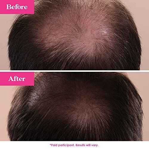 Grande Cosmetics GrandeHAIR Hair Enhancing Serum for Men and Women, Promotes Thickness in Thinning Hair, Safe for Color Treated Hair
