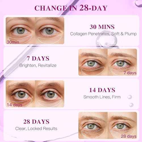 Collagen Under Eye Patches for Puffy Eyes and Dark Circles, Under Eye Mask for Puffiness, Hydrating Undereye Mask Patches for Treatment with Women Beauty (White, 12 Pairs)