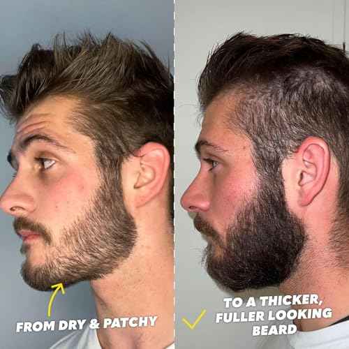 The Beard Club Supreme Beard Growth Kit - Derma Roller, Growth Oil, Vitamins, Vitamin Spray, Biotin Balm, Thickening Conditioner, Shampoo, Comb & Cleansing Spray - Gift Set