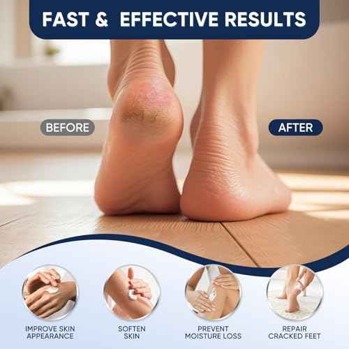 Urea Cream 60 Percent for Feet Maximum Strength, Urea Cream 60% Plus Salicylic Acid 2%, Foot & Hand Cream for Dry Cracked