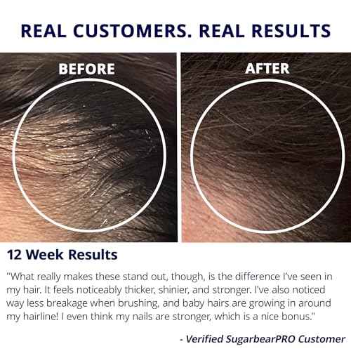 Sugarbear Gentle Detangling Bamboo Hair Brush + Vegan Hair Vitamin Gummies 3 Month Supply, Extra Strength Biotin 6000mcg for Supporting Healthy Straight, Wavy, Curly & Kinky Hair