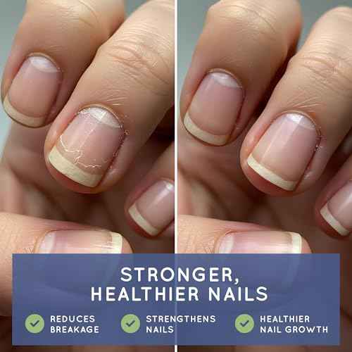 Essential Source Biotin (Biotina Vitaminas) - Hair Skin Nails Vitamins for Women & Men - 5000 mcg - Hair Growth Support Supplements - 90 Tablets - with Revytalyz 5, Vitamin A, C, B12 - Made in USA