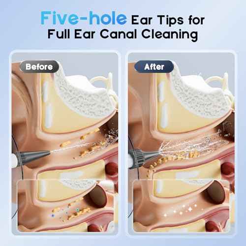 Ear Wax Removal - Ear Cleaner with 4 Pressure Modes, Ear Cleaning Kit with Digital Temperature Display, Safe & Effective Ear Irrigation Flushing System (White)