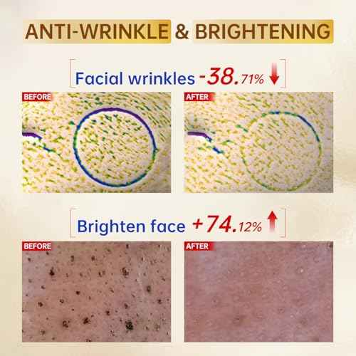 Vitamin C Face Serum with Vitamin C, Hyaluronic Acid, Vitamin E, Serum for Dullness, Balanced Complexion, Eye Area, Fine Lines & Wrinkles, 30ml/1.01oz