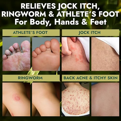 Antifungal Soap | Deep-Cleansing & Exfoliating Bar for Men & Women | Natural Ingredients with Tea Tree & Eucalyptus | Helps Soothe Jock Itch, Ringworm & Athlete¡¯s Foot Pumice Bar Soap