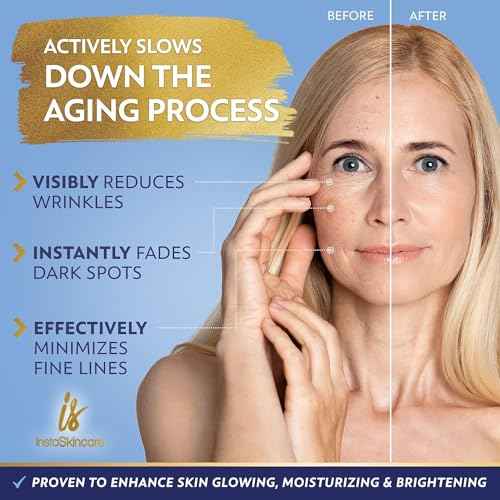 Niacinamide Serum 8Oz for Face 10% with Zinc 1% Vitamin B3 Brightening Serum for Tone, Texture