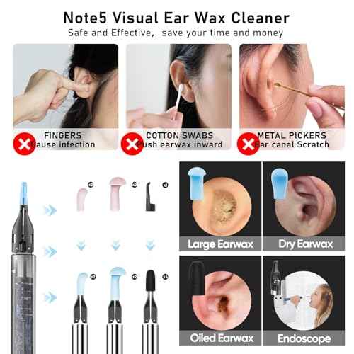 Note5 Ear Wax Tweezers with Camera, 10MP Ear Cleaner Camera Otoscope with Light,Real-time Remote Video with Ear Pick & Tweezers,12 Pcs Ear Scoops for Whole Family
