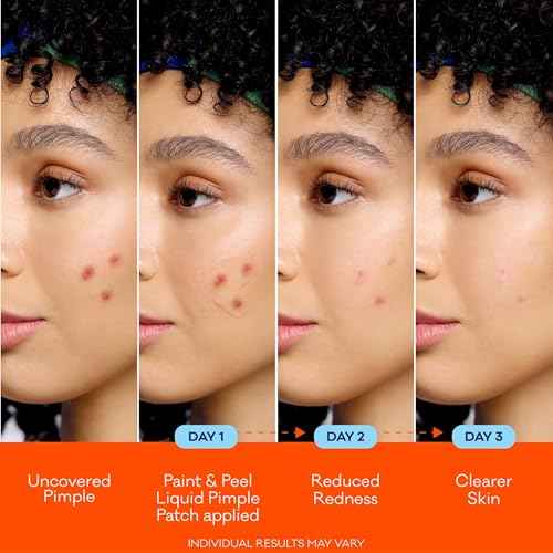Bior? Paint & Peel Liquid Pimple Patch, Invisible Pimple Patch with Salicylic Acid, Up to 100 Uses, .5 Oz