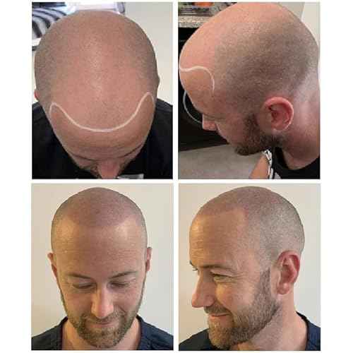 Nuva Scalp Micro-Pigmentation Ink - Customizable, Neutral Undertone for SMP Procedures, Vegan, Made in USA (SMP (8-Pack))