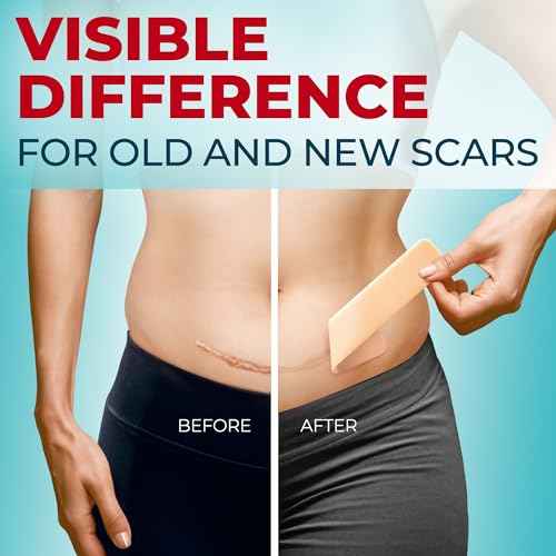 Medical Grade Silicone Scar Sheets - 6pk (5.7¡±x1.6¡±) - Visible Difference on Surgical & Keloid Marks - Reusable C-Section Scar Silicone Strips - Easy to Use Strips