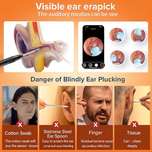 Ear Wax Removal - Earwax Remover Tool with 8 Pcs Ear Set, Ear Cleaner with 2400P HD Camera with 6 LED Lights, Built-in WiFi,Ear Cleaning Kit for iOS and Android
