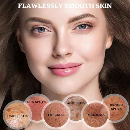 Dark Spot Remover for Face and Body: Dark Spot Corrector Cream, Melasma, Freckle, Sun Spot, Age Spot Remover with Niacinamide and Vitamin C, Advanced Formula for Women and Men (1.7 Fl Oz)