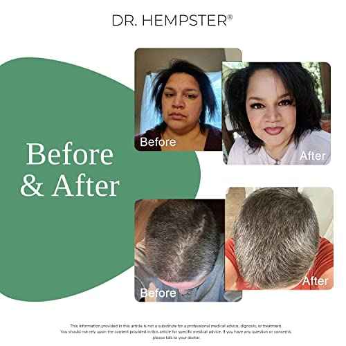 Biotin & Hemp Natural Shampoo 2 Pack - Thinning Hair and Hair Loss Treatment - Volumizing Treatments for Women and Men - Hair Growth Shampoo - Paraben & Sulfate Free - for All Hair Types