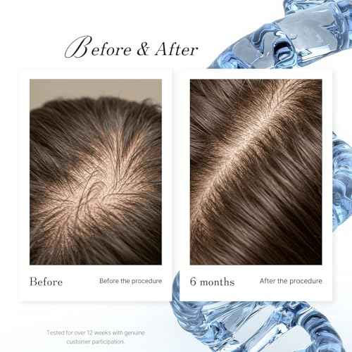 DNA-Pollen Hair Growth Stimulating Treatment Proven Effective Against Hair Loss for Thicker and Fuller Hair