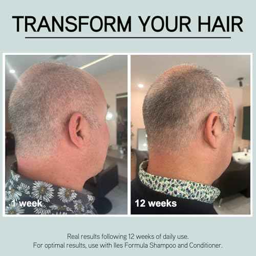 ILES FORMULA Grey Delay Anti Gray Hair Booster ? Botanical Leave-In Treatment Spray with Silverfree and Melanogray to Restore Natural Hair Color and Prevent Premature Greying, 1-Month Supply