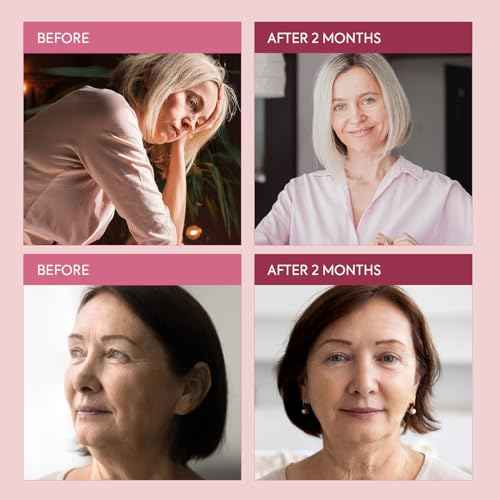 Vigority Bioidentical Estriol Face Cream for Women: Natural Estrogen Moisturizer Cream with Wild Yam - Hydrates, Firms & Revitalizes Skin