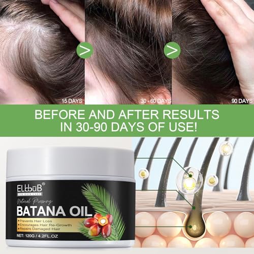 Raw Batana Oil for Hair Growth - 100% Natural Organic Hair Oils for Growth and Thickness from Honduras, Hair Loss Treatments for Black Women Men