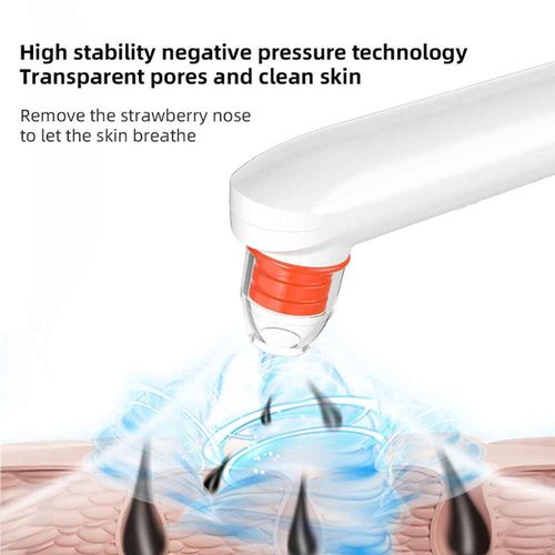 Blackhead Remover Vacuum,Blackhead Remover Tool with HD Camera & USB Charging - Pimple Extractor Vacuum,3 Stops & 4 Suction Heads Pore Extractor (White) (White)