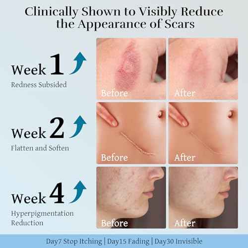 Advanced Scar Cream, Scar Reduction Treatment for Improves Skin Texture & Helps Remove Acne, Stretch Marks, Surgery, C Section, Burn, Keloid & Hypertrophic Scars 1.76 Oz (50g)