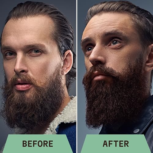 Striking Viking Beard Shampoo with Tea Tree, Biotin & Jojoba Oil - 17 oz Deep Cleansing, Paraben & Sulfate Free for All Beard Types