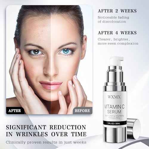 Super Vitamin C Face Serum for Mature Skin: All-in-One Hydrating Anti-Aging Formula by Vitamin C, Hyaluronic Acid, Caffeine-Firming, Lifting, Targets Dark Spots, Wrinkles, 1 fl oz (Pack of 1)