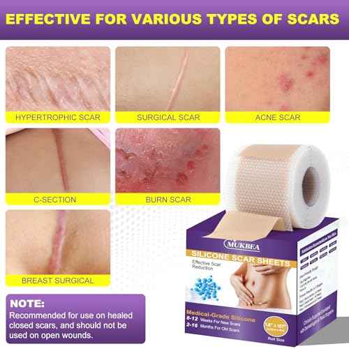 Silicone Scar Sheets, Silicone Scar Tape, Scar Tape for Keloid Bump Removal, Reusable Silicone Scar Strip for C-Section, Keloid, Surgery, Burns, Acne Scar et(1.8¡±x157¡±Roll-4M)
