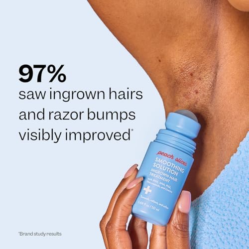 Peach Slices - Smoothing Solution Ingrown Hair Treatment (1.69 oz) - Smooth, Relieve, Soften Skin - 360 Roller - BHA, AHA, PHA, Niacinamide, Licorice - Vegan & Cruelty Free - Korean Skin Care & Beauty