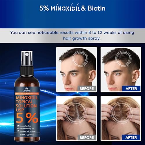 5% Minoxidil for Men & Women, Hair Beard Growth Spray with Biotin, Minoxidil Hair Growth Serum for Hair Regrowth, for Hair Loss & Thinning, make Hair Stronger Thicker -3.38 fl.oz /100ml