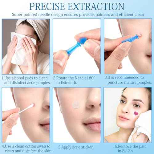 Sterile Needles for Pimples, 50 Pcs Disposable Sterile Pimple Needle and 72 Dots Acne Stickers, Pimple Popper Needle for Clear Skin, Acne Needles Tool for Milia Remover