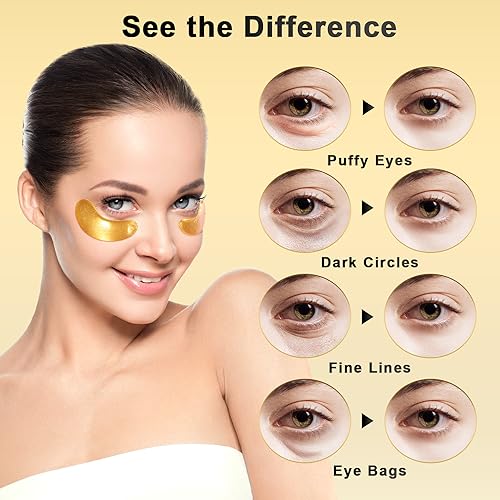 Under Eye Patches (12 Pairs) - 24K Gold Eye Masks Treatment for Eye Bags, Puffy Eyes & Dark Circles - Nourishing Skin Care Product - Birthday Gifts for Women - Vegan & USA Tested