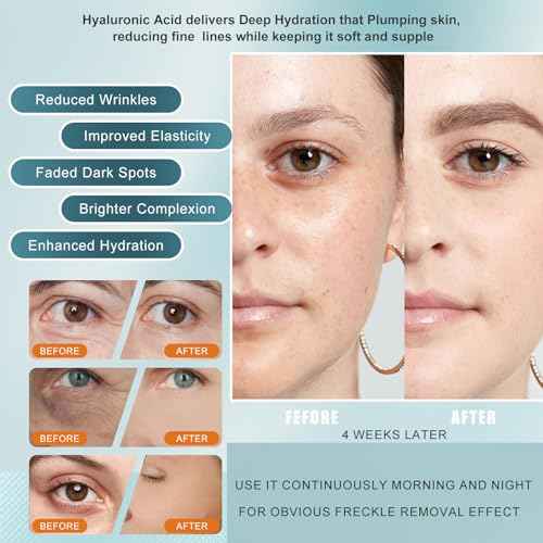 Super Vitamin C Face Serum, with Vitamin C, Hyaluronic Acid, Tripeptides, firms and lifts skin, Targets Dark Spots and Wrinkles, total package serum, Anti-Aging Formula for Mature Skin -1 fl. oz