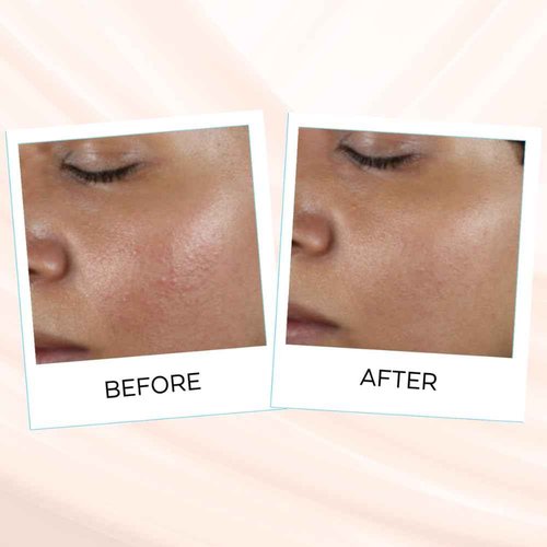 Yunasence SELENIYA Nourishing Skin Barrier Concentrate Oil, with Ceramide, Peptide, Microalgae, Selenium, 1oz For sensitive, compromised, thin, dry skin and rosacea.