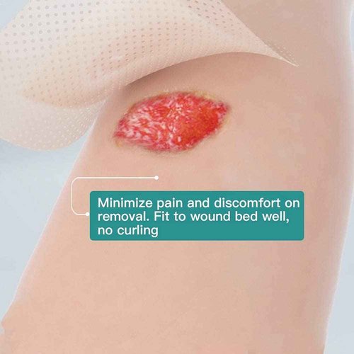Plus Bundle to Release Pressure on Partial Skin