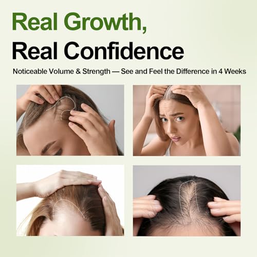 Hair Growth Oil Foam with Rosemary and Castor Oil Vegan Natural Formula for Thinning Hair Organic Plant Based Scalp Treatment Non Greasy Hair Regrowth Support for Men and Women 3 Bottles Each 2.11 oz