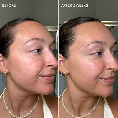 Dermisa Skin Fade Cream with Vitamin C | Helps Reduce Dark Spots and Age Spots | All Skin Types | 1.78 OZ | Pack of 1