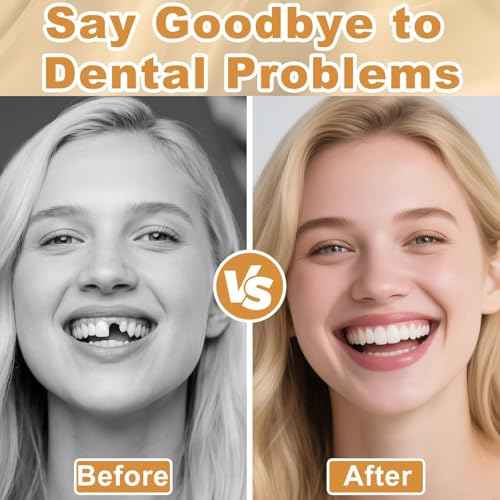 Moldable False Teeth, Veneers Teeth for Women and Men, Upper and Lower Matching Set Tooth Repair Kit, Fix Your Smile at Home Within Minutes, 1PCS-Q