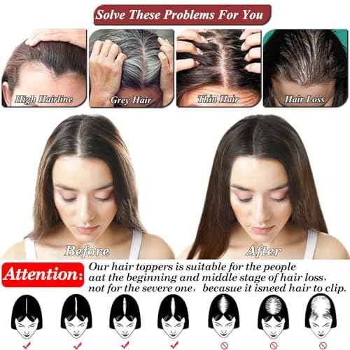 JGS1996 Hair Toppers for Women Real Human Hair 150% Density Hand Made Lace Base Remy Hair Wig Topper with Thinning Hair Pieces No Bangs Clip in Hair Extensions