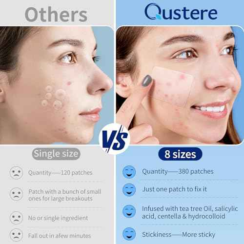 Large Pimple Patches for Face, Hydrocolloid Acne Patches, Variety Shapes Zit Covers, Stickers with Tea Tree, Salicylic Acid & Cica Oil| Round,Moon,Strip,Square,Rectangle,Nose Strip |8 Sizes |380 Count
